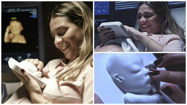 RT 3D ultrasound printed out for blind mother. This is amazing  - embedded image 